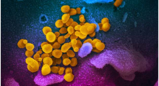 the virus that causes COVID-19—isolated from a patient